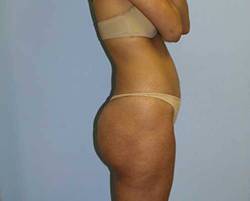 After Image: Patient # 25322 - 