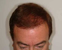 After Image: Patient # 89786 - 