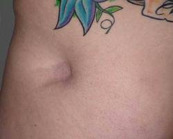 Before Image: Patient # 15547 - 
