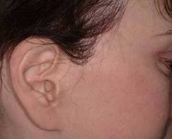 After Image: Patient # 70553 - 