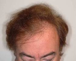 Before Image: Patient # 89786 - 
