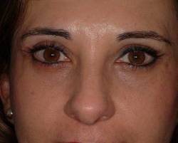 After Image: Patient # 23251 - 