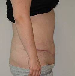 After Image: Patient # 30262 - 