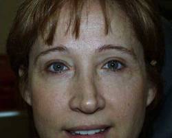 After Image: Patient # 66570 - 