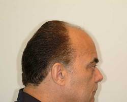 Before Image: Patient # 84213 - 