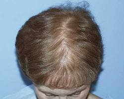 Before Image: Patient # 89341 - 