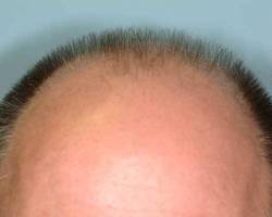 Before Image: Patient # 10068 - 