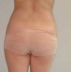 After Image: Patient # 79803 - 
