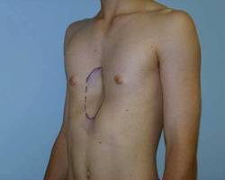Before Image: Patient # 19979 - 