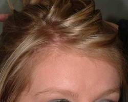 After Image: Patient # 24673 - 