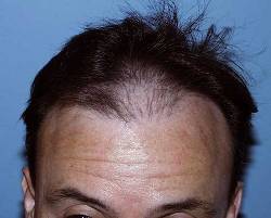 Before Image: Patient # 20729 - 