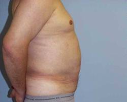 After Image: Patient # 84231 - 