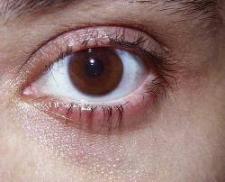 Before Image: Patient # 94401 - 
