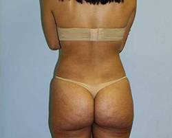 After Image: Patient # 25322 - 
