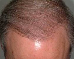 After Image: Patient # 41082 - 