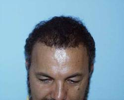 After Image: Patient # 30986 - 