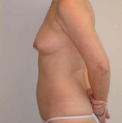 Before Image: Patient # 24518 - 