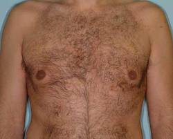 After Image: Patient # 84584 - 
