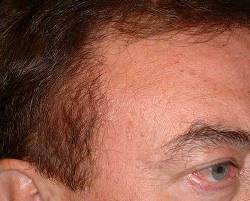 After Image: Patient # 89786 - 