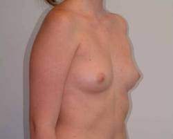 Before Image: Patient # 66213 - 