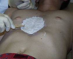 Before Image: Patient # 19979 - 