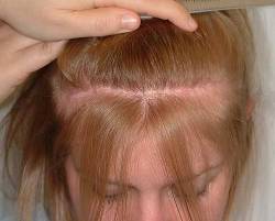 Before Image: Patient # 24673 - 