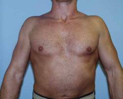 After Image: Patient # 58006 - 