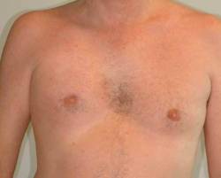 After Image: Patient # 78514 - 