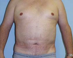 After Image: Patient # 84231 - 