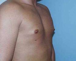 After Image: Patient # 57972 - 