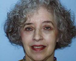 After Image: Patient # 86576 - 