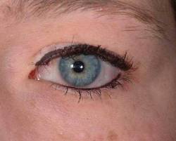 After Image: Patient # 10992 - 