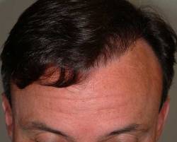 After Image: Patient # 20729 - 