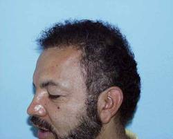 After Image: Patient # 30986 - 