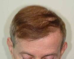 Before Image: Patient # 15207 - 