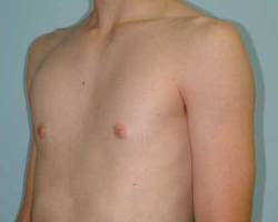 After Image: Patient # 19979 - 