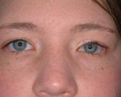 After Image: Patient # 10992 - 
