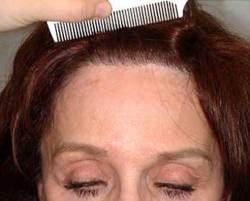 After Image: Patient # 99398 - 