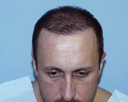 After Image: Patient # 12498 - 