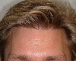 After Image: Patient # 24703 - 