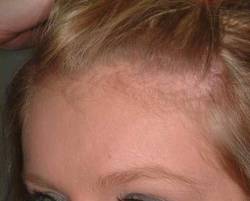 After Image: Patient # 24673 - 