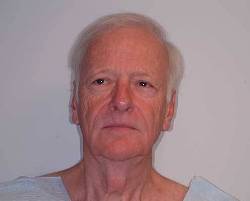 Before Image: Patient # 11305 - 