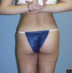 After Image: Patient # 89230 - 