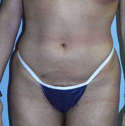 After Image: Patient # 47300 - 