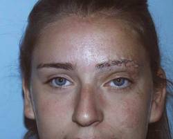 After Image: Patient # 65694 - 