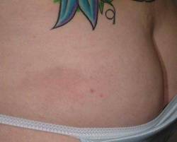 After Image: Patient # 15547 - 