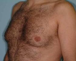 Before Image: Patient # 84584 - 