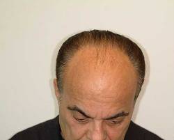 Before Image: Patient # 84213 - 