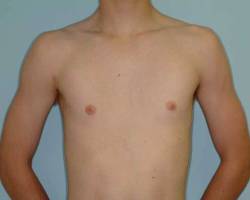 After Image: Patient # 19979 - 