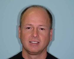 Before Image: Patient # 10068 - 